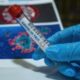 Коктейль антител сокращает смертность от коронавируса на 70%