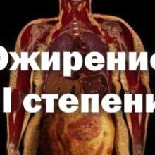 Ожирение 2 степени у женщин: особенности лечения и принципы диетического питания