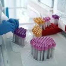 Ученые выяснили, почему для диабетиков особо опасен коронавирус