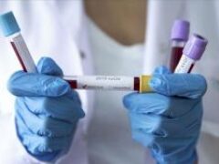 В Украине за сутки выявили 619 инфицированных на коронавирус
