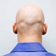 Названы простые способы профилактики выпадения волос