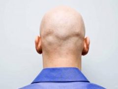 Названы простые способы профилактики выпадения волос