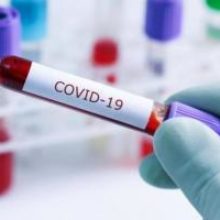 За минувшие сутки коронавирус в Украине обнаружили у 1746 человек