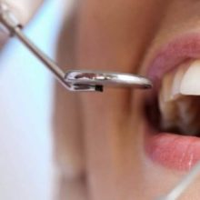 Лечение кариеса: забота о здоровье ваших зубов