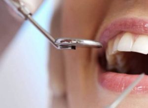 Лечение кариеса: забота о здоровье ваших зубов